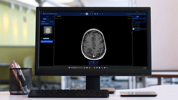 neuroimage2025.gif
