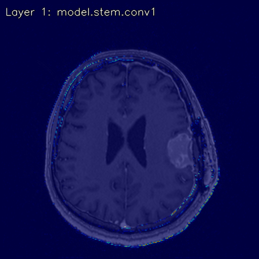 xai_glioblastoma2025.gif